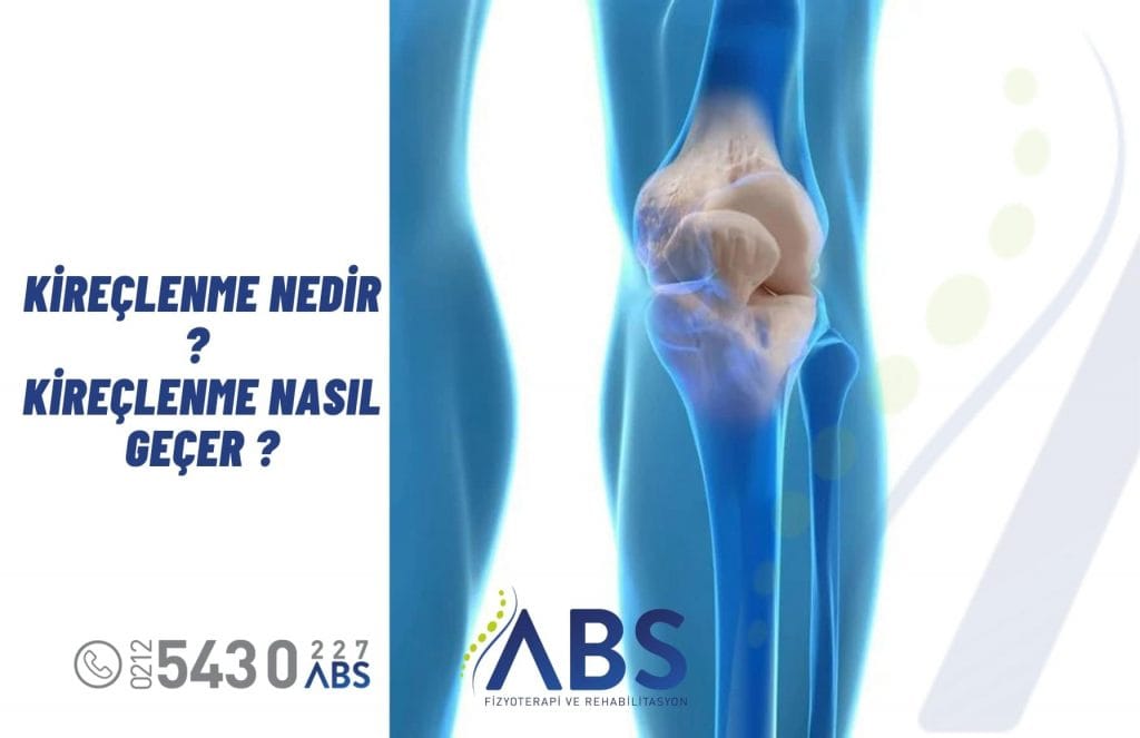 Kireçlenme Nedir ? Kireçlenme Nasıl Geçer ?