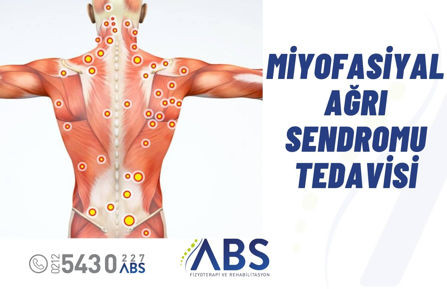 Miyofasiyal Ağrı Sendromu Tedavisi