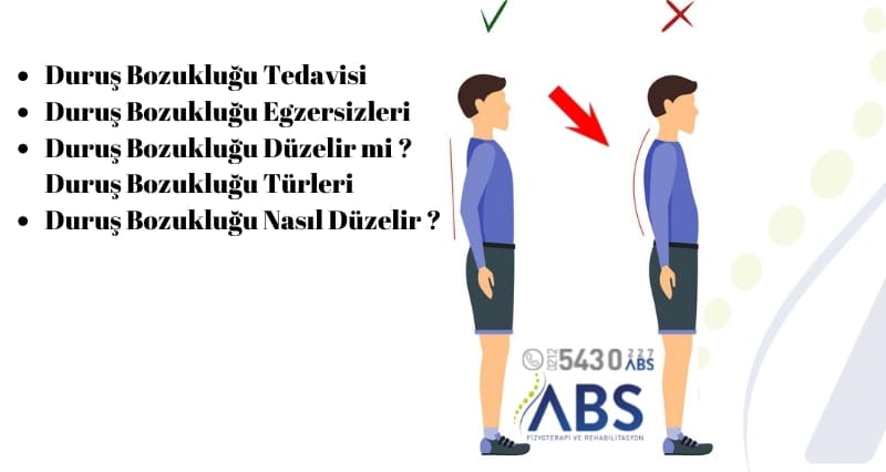 Duruş Bozukluğu Tedavisi