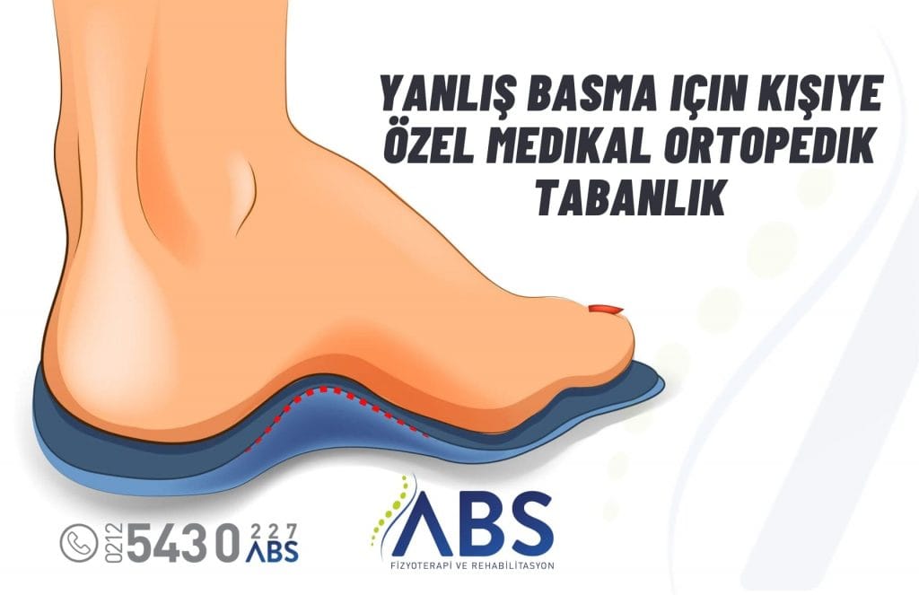 yanlış basma için ortopedik tabanlık