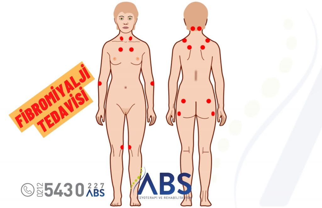 Fibromiyalji Tedavisi