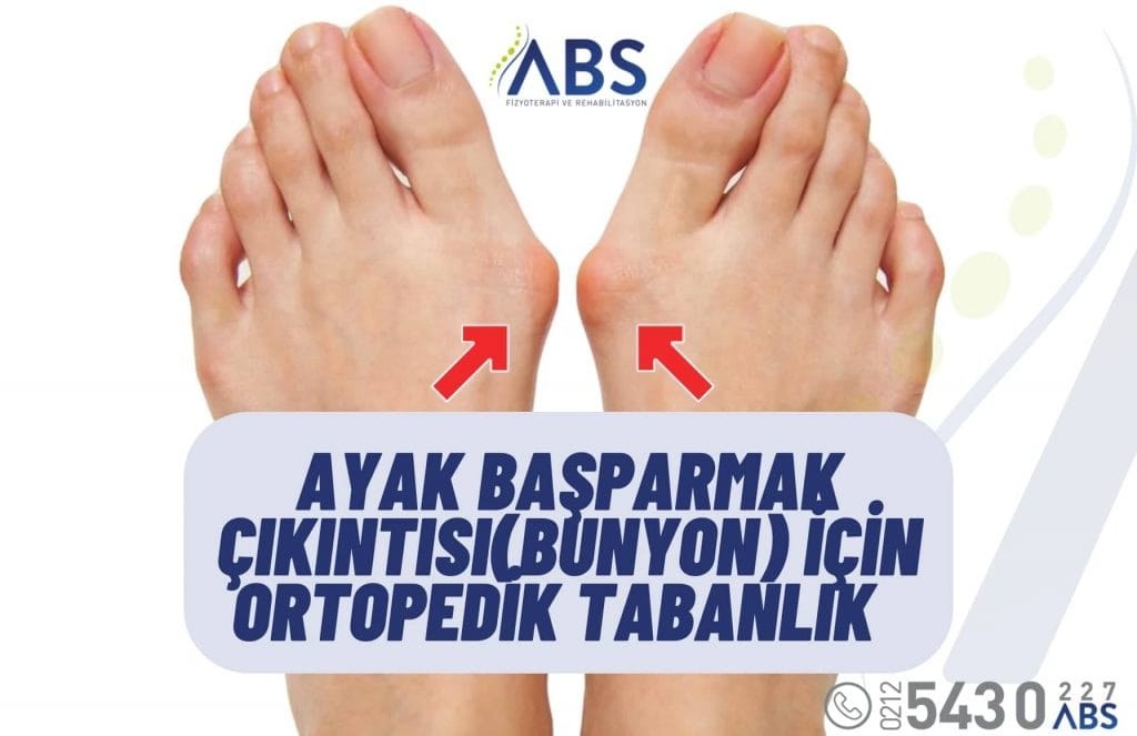 Ayak Başparmak Çıkıntısı Tedavisi