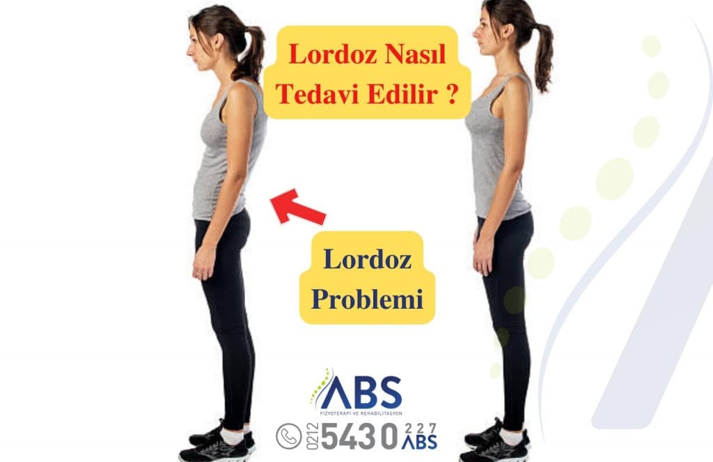 Lordoz Tedavisi