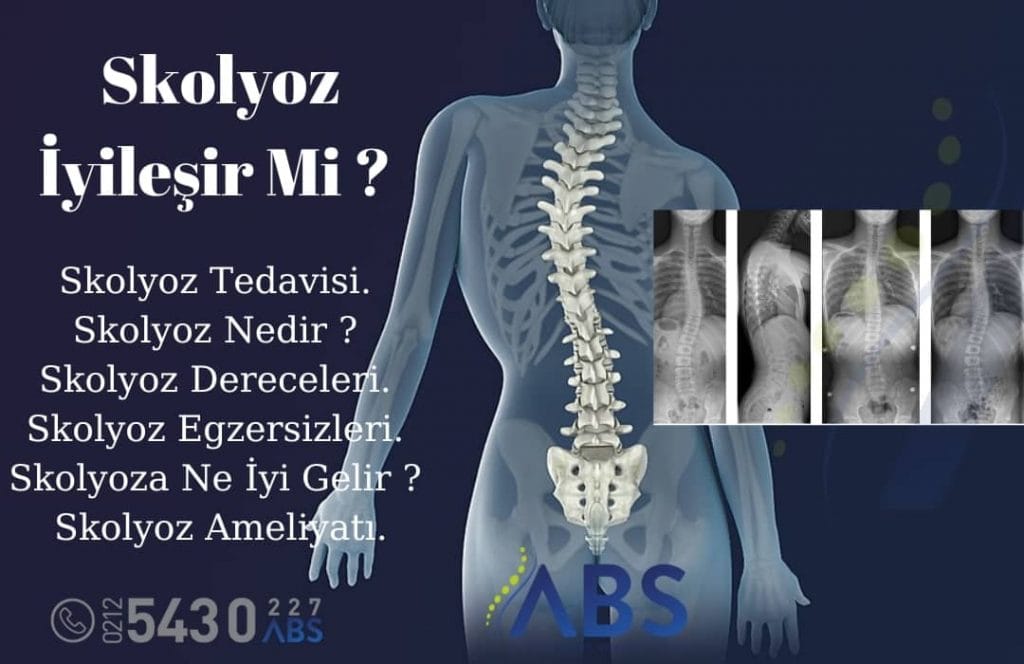 skolyoz tedavisi