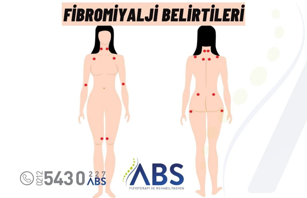 Fibromiyalji Belirtileri
