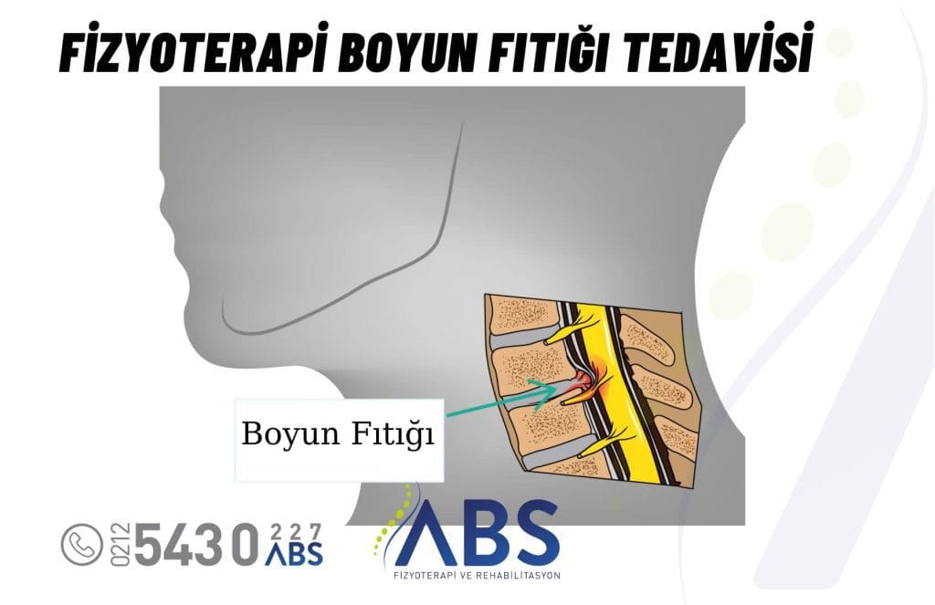 Fizyoterapi Boyun Fıtığı Tedavisi
