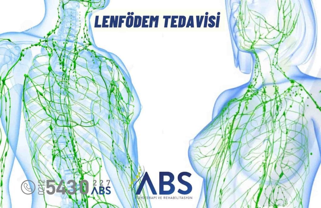 Lenfödem Tedavisi