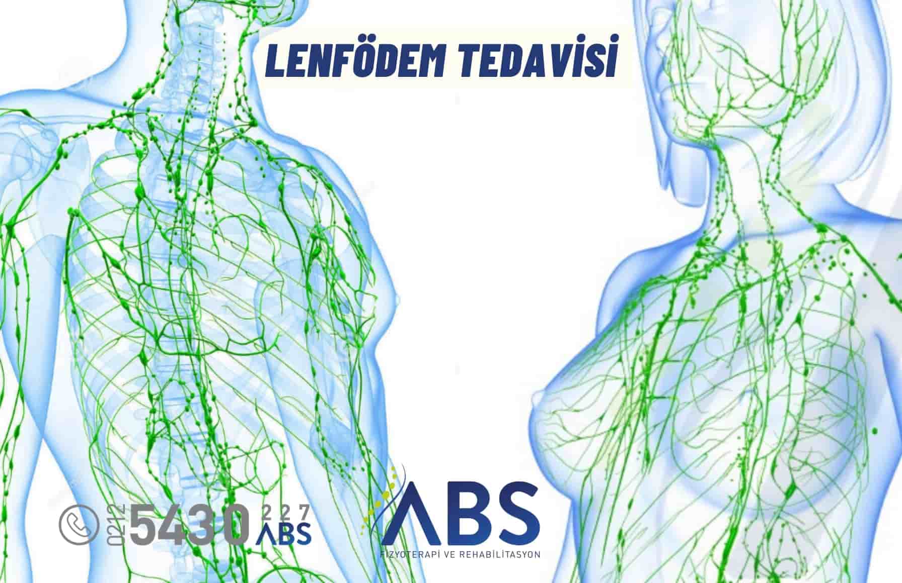 Lenfödem Tedavisi