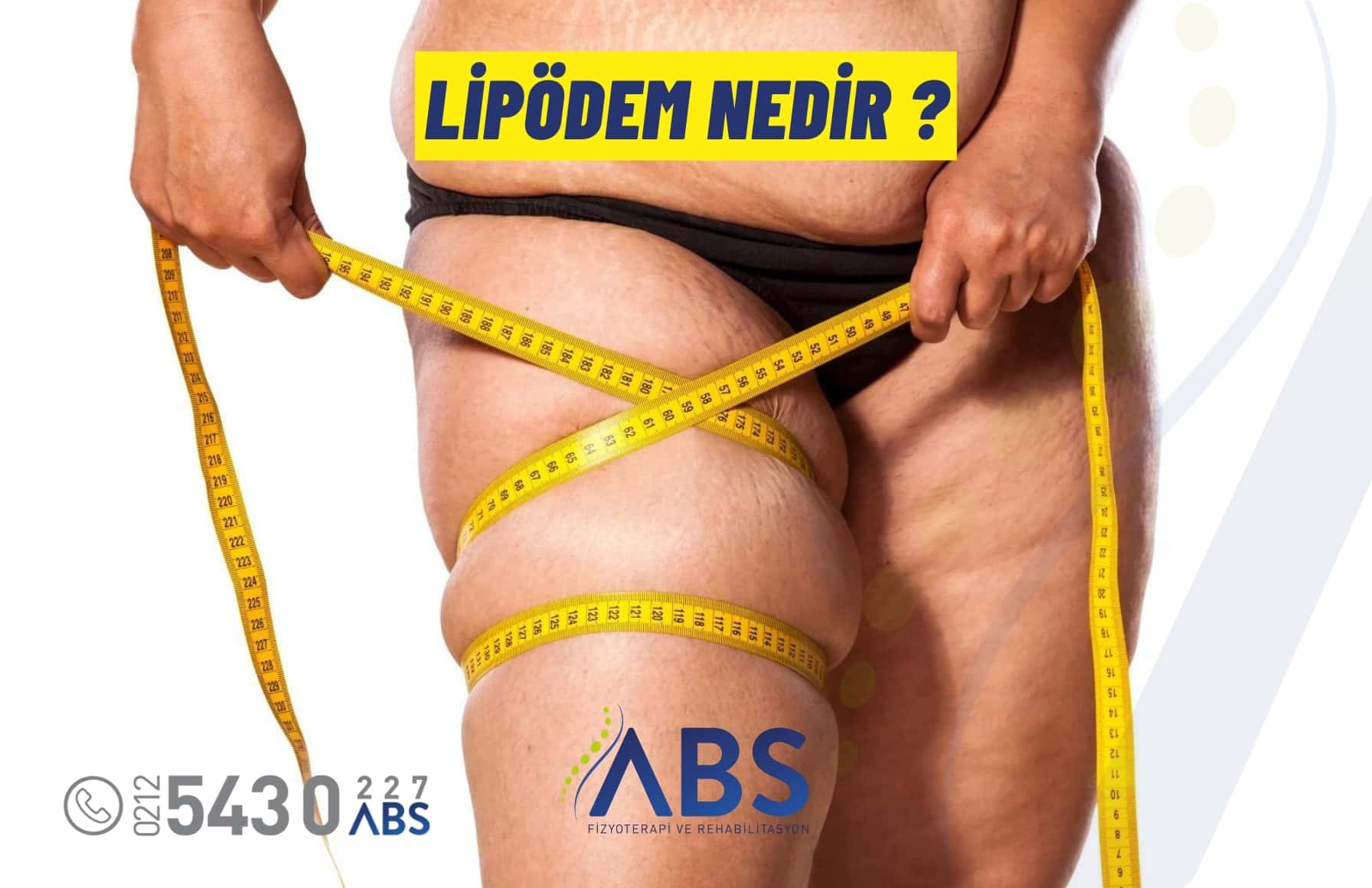 Lipödem Nedir ?
