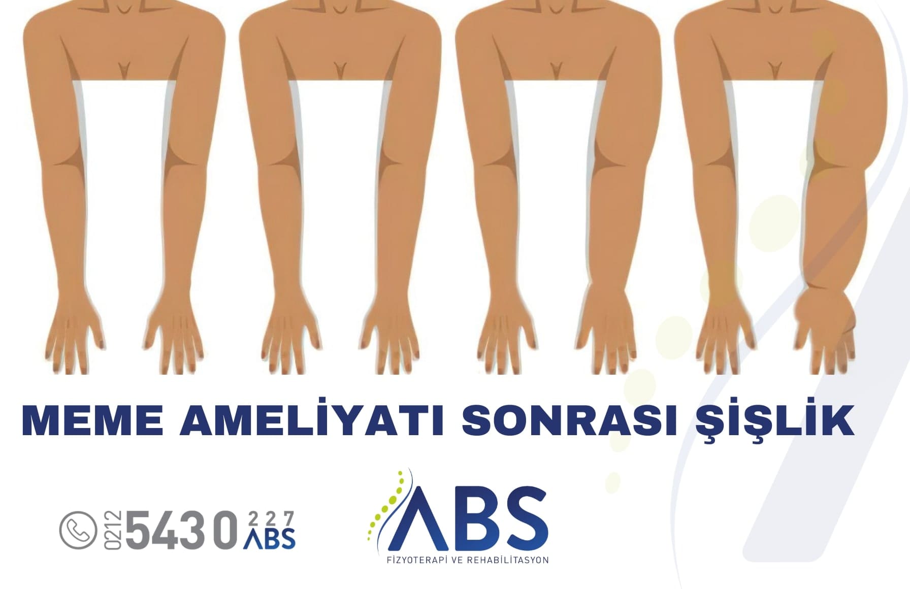 Meme Ameliyatı Sonrası Şişlik