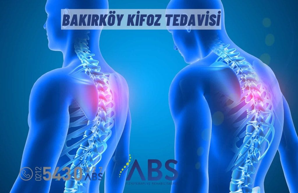 Bakırköy Kifoz Tedavisi