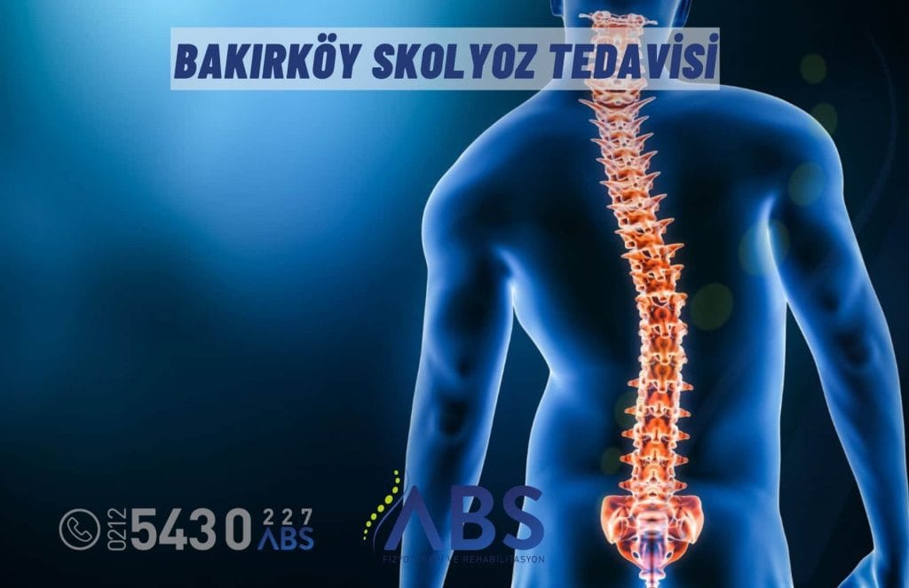 Bakırköy Skolyoz Tedavisi