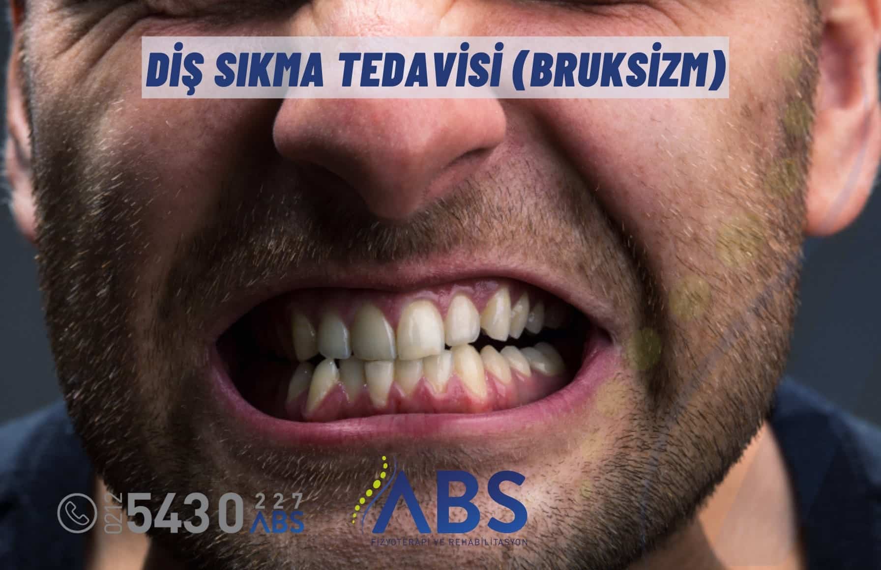 Diş Sıkma Tedavisi (Bruksizm) ve Fizyoterapist Etkisi