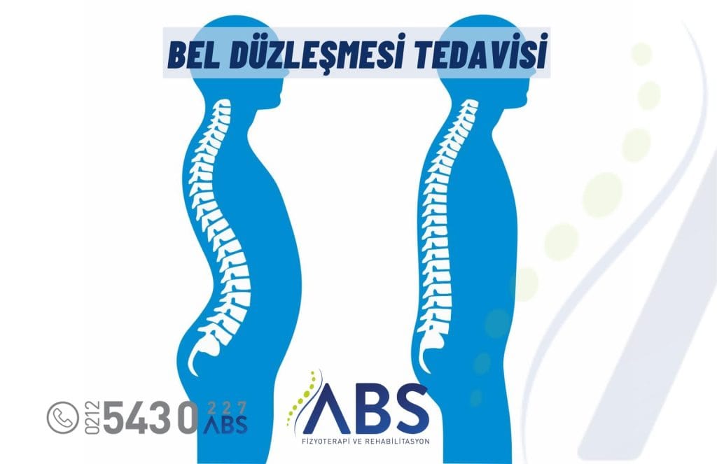 Bel Düzleşmesi Tedavisi