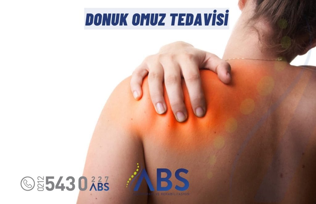 Donuk Omuz Tedavisi