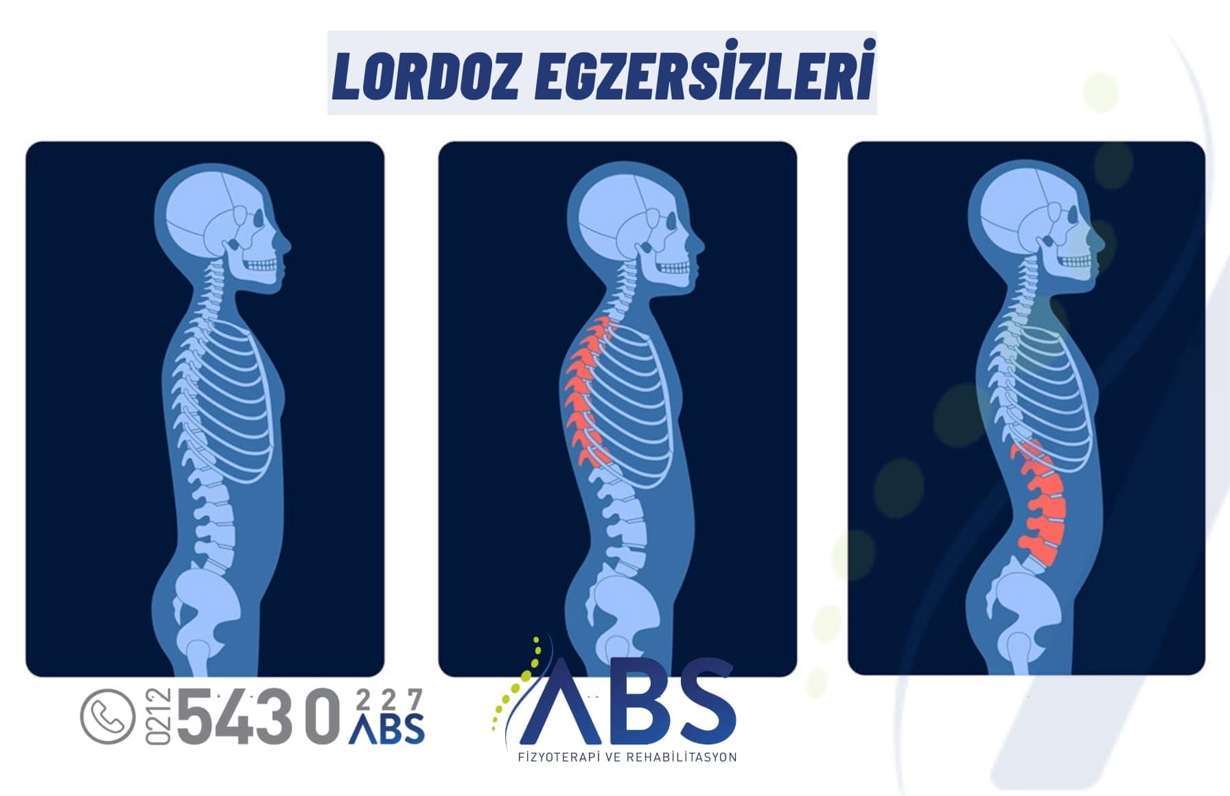 Lordoz Egzersizleri