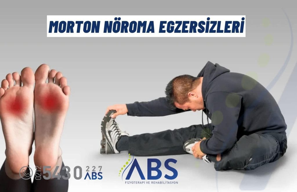 Morton Nöroma Egzersizleri
