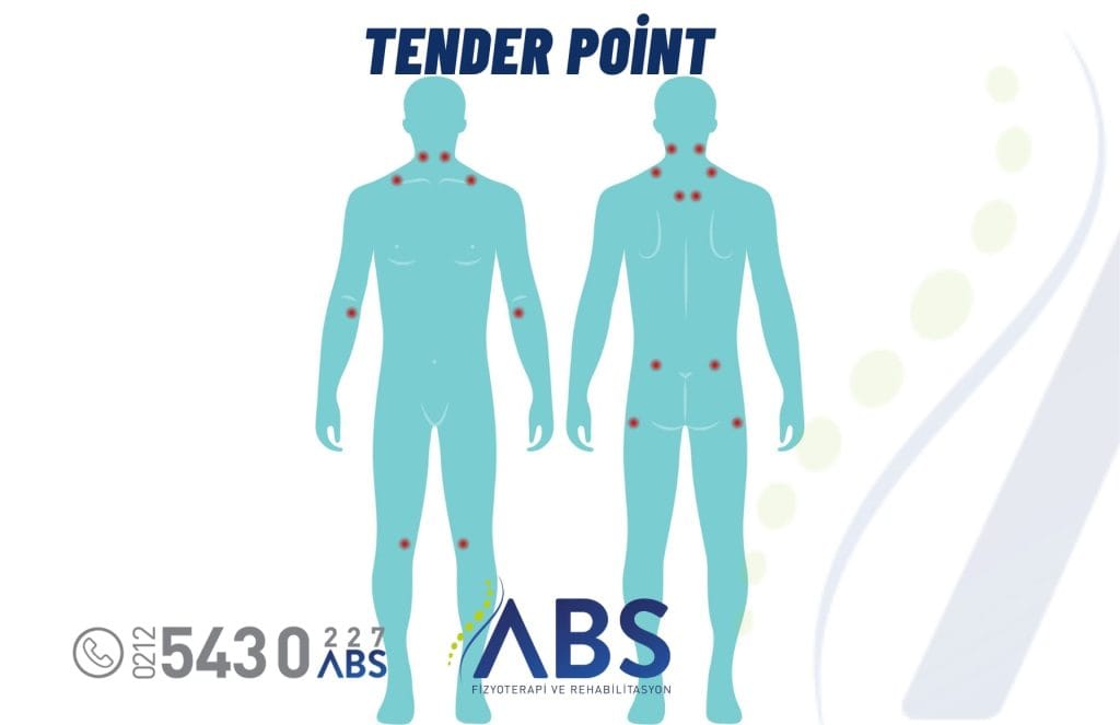 Tender Point