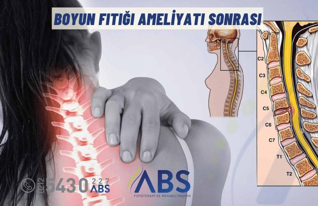 Boyun Fıtığı Ameliyatı Sonrası