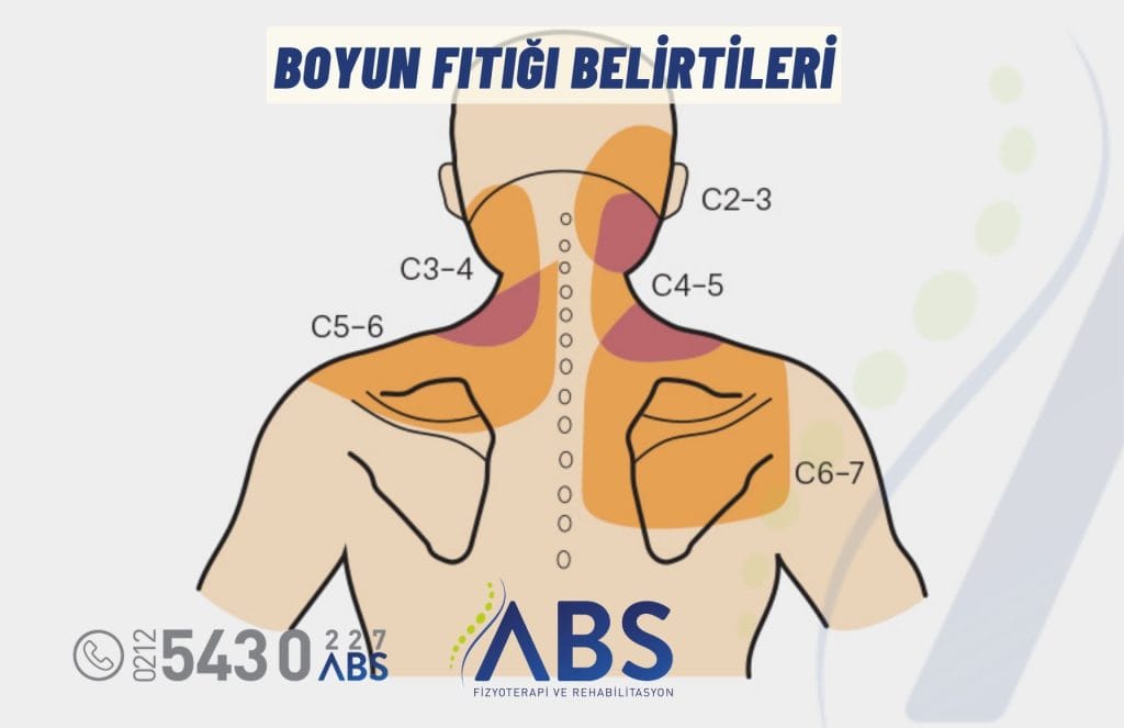 Boyun Fıtığı Belirtileri