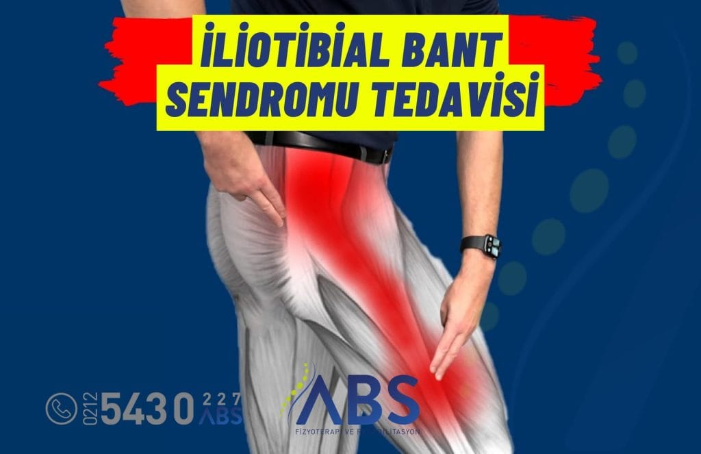 İliotibial Bant Sendromu Tedavisi