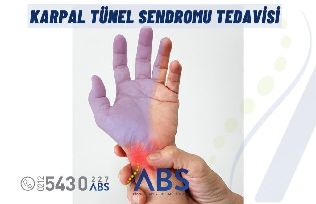 Karpal Tünel Sendromu Tedavisi