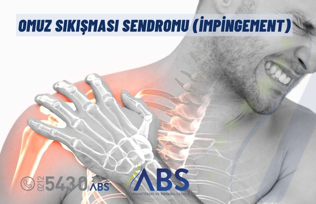 Omuz Sıkışması Sendromu