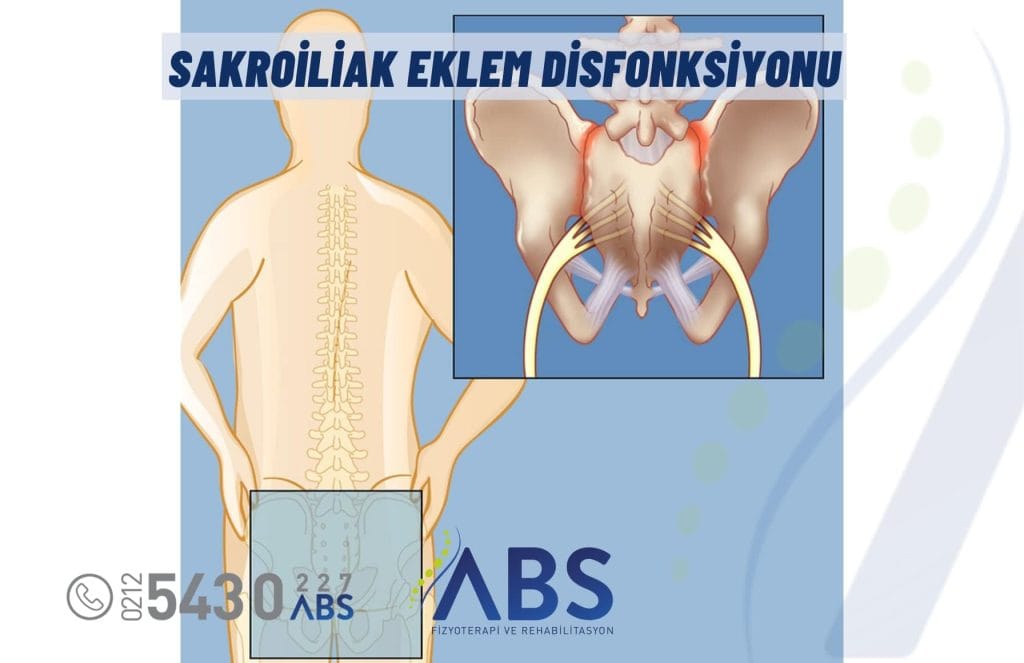 Sakroiliak Eklem Disfonksiyonu
