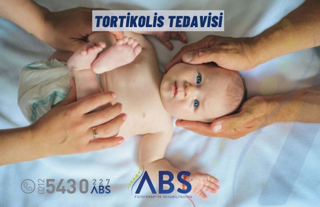 Tortikolis Tedavisi