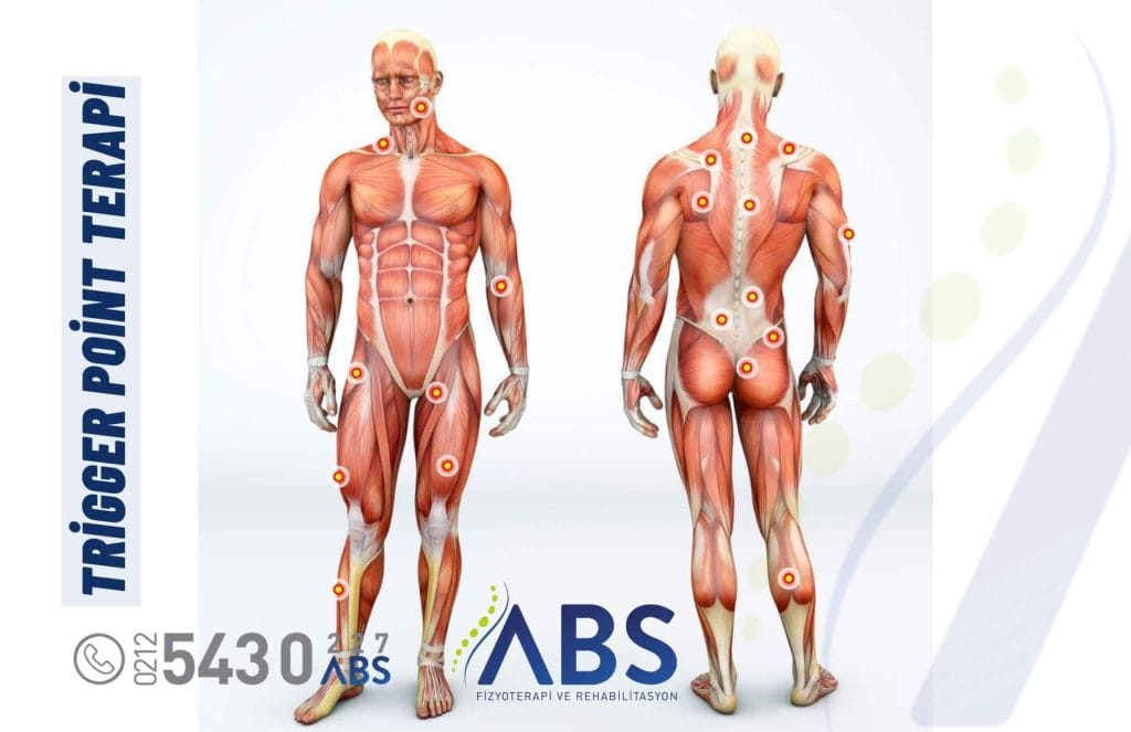 Trigger Point Terapi
