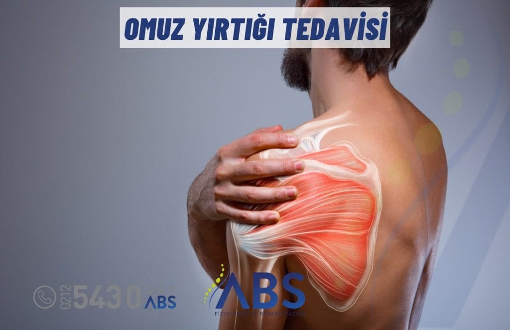 Omuz Yırtığı Tedavisi
