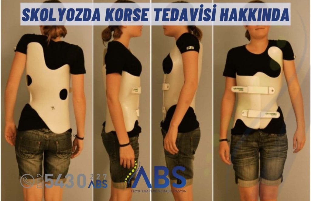 Skolyozda Korse Tedavisi