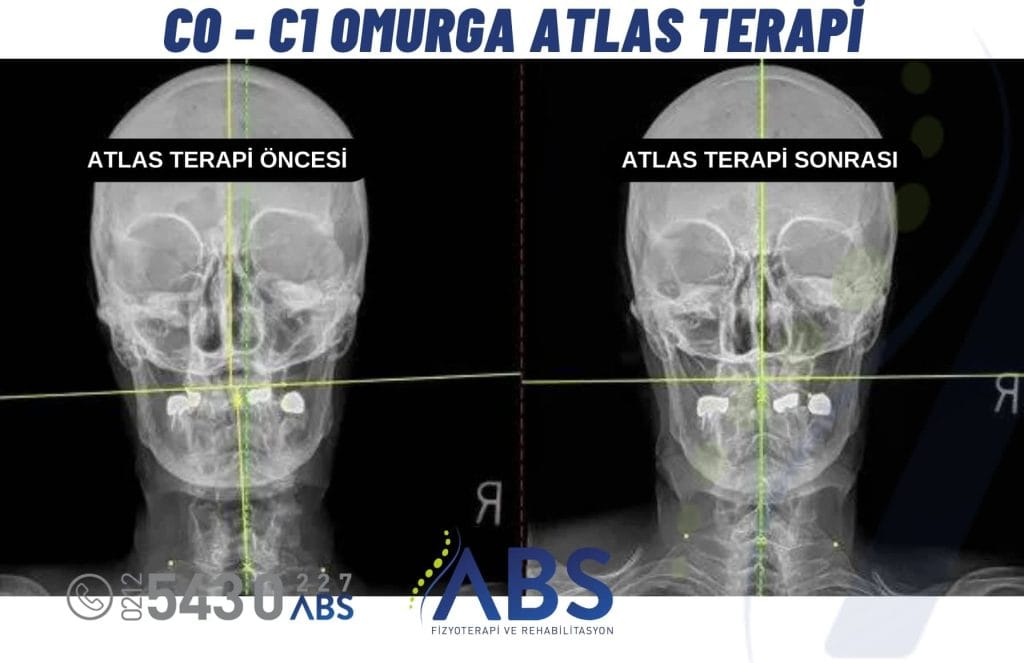 Atlas Terapi