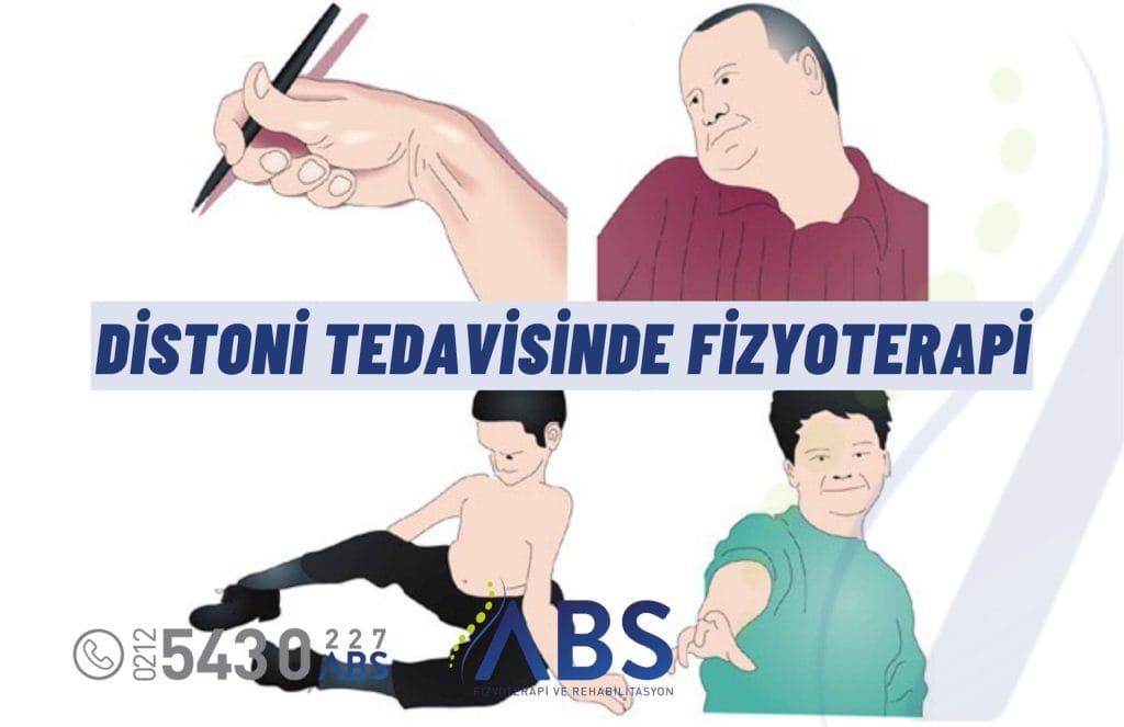 Distoni Tedavisinde