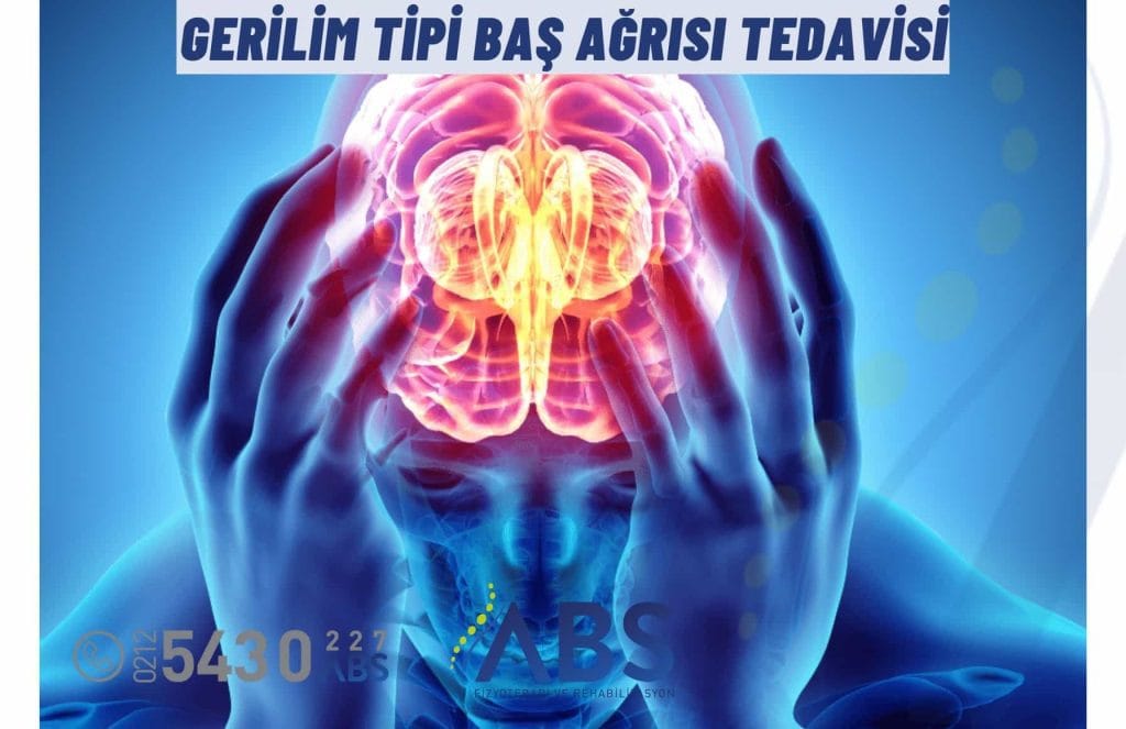 Gerilim Tipi Baş Ağrısı Tedavisi