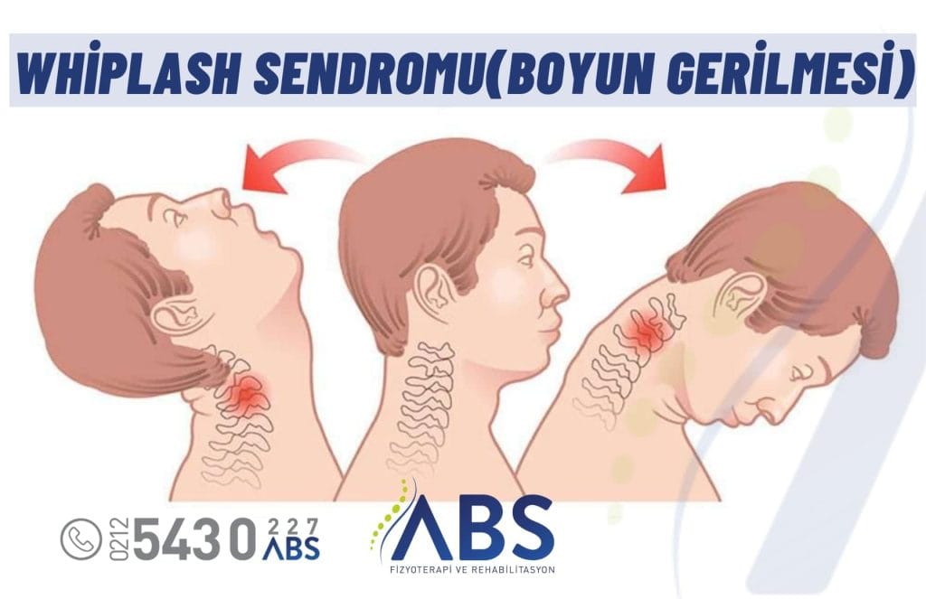 whiplash yaralanması