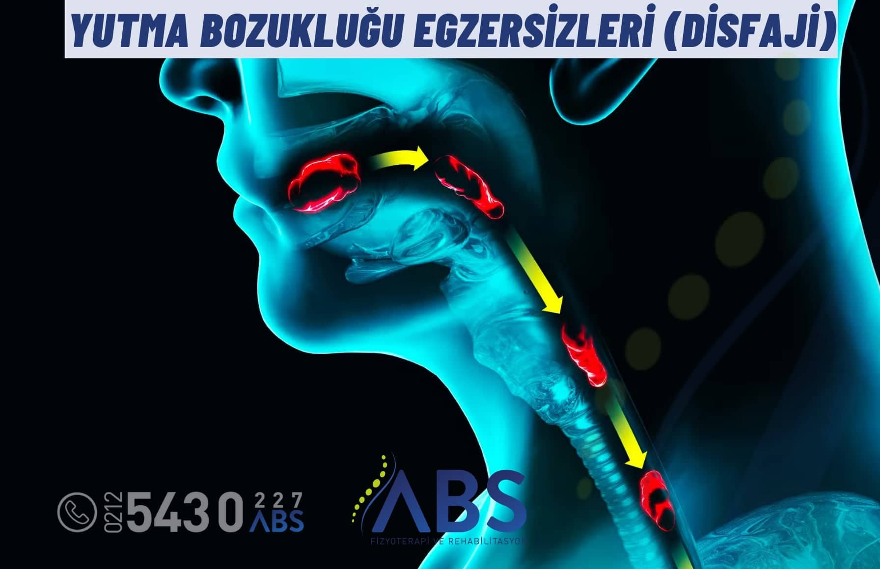 Yutma Bozukluğu Egzersizleri (Disfaji)