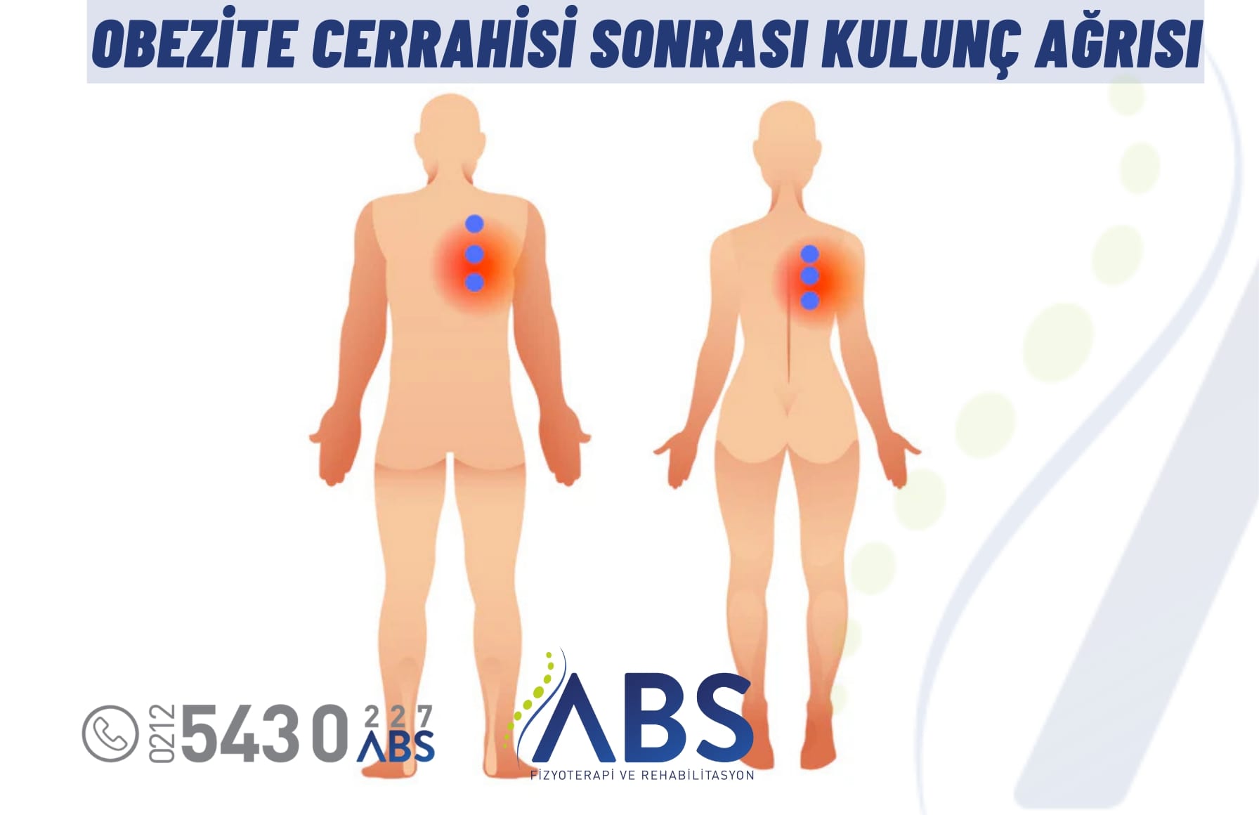 Obezite Ameliyatı Sonrası Kulunç Ağrısı