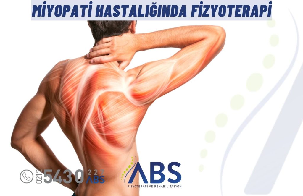 Miyopati Hastalığında Fizyoterapi ve Rehabilitasyon