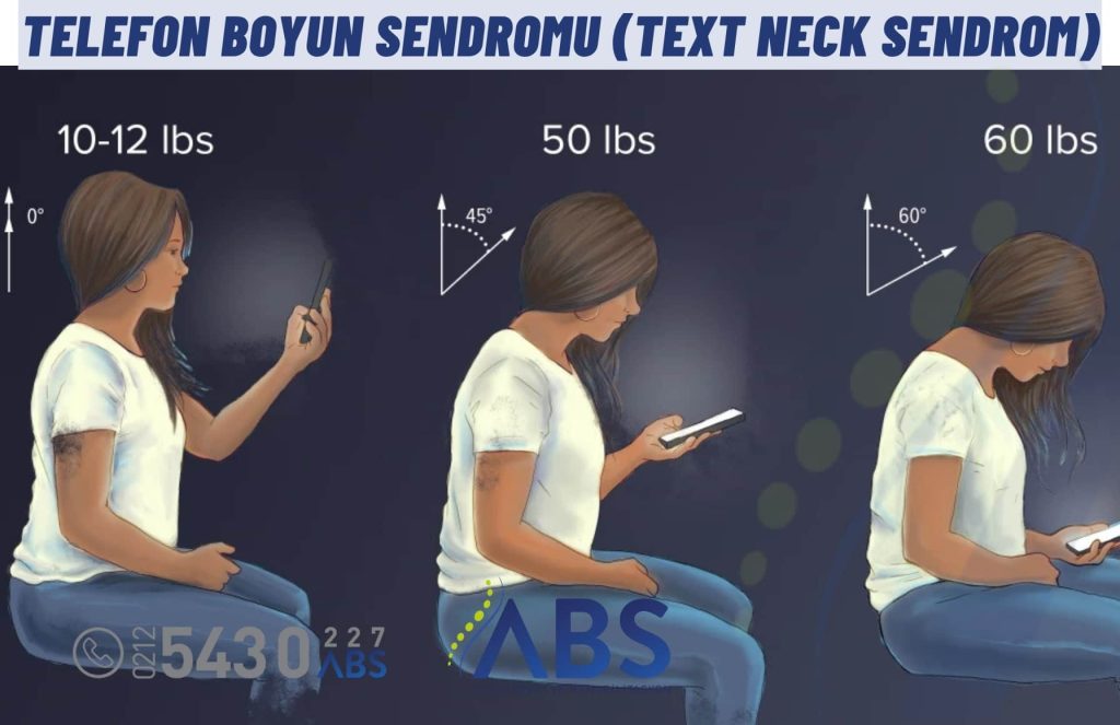 Telefon Boyun Sendromu (Text Neck Sendrom)
