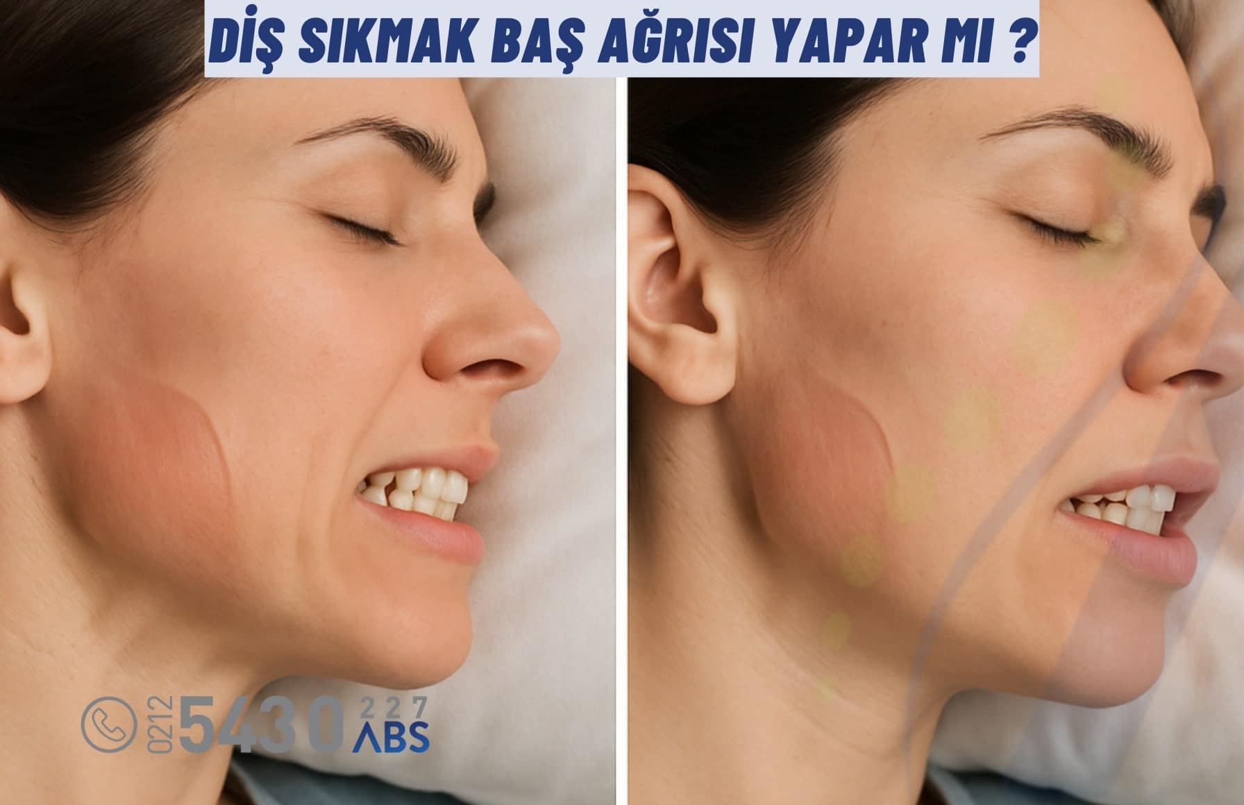 Diş Sıkmak Baş Ağrısı Yapar mı ?