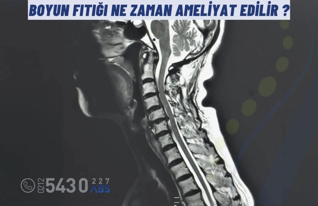 Boyun fıtığı ne zaman ameliyat edilir sorusuna fizyoterapist bakış açısıyla açıklama görseli.