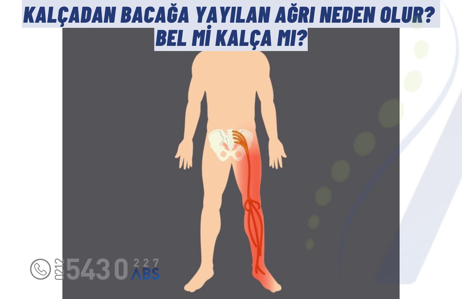 Kalçadan Bacağa Yayılan Ağrı Neden Olur?
