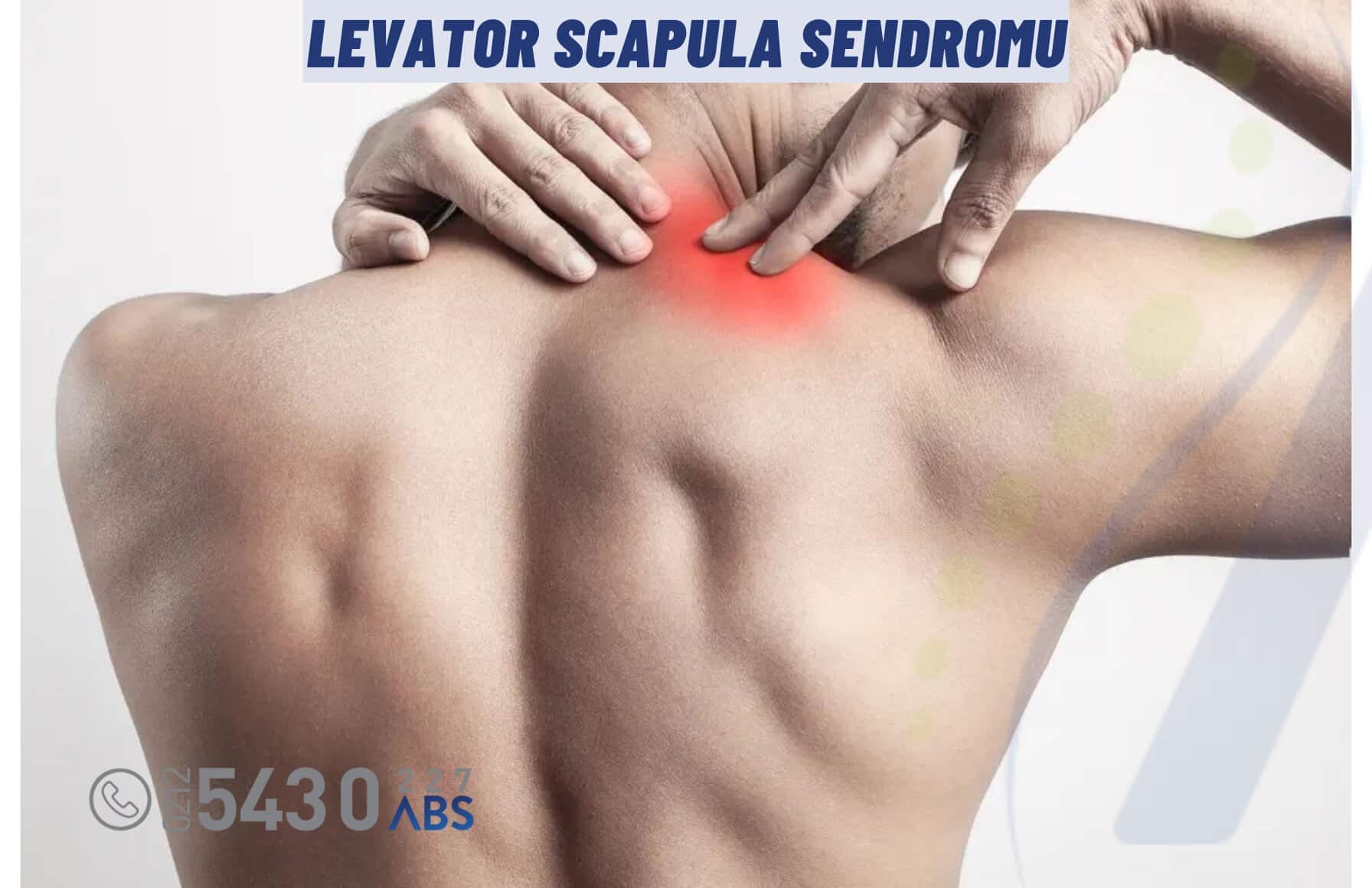 Levator Scapula Sendromu