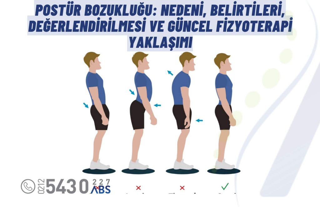 Postür bozukluğu değerlendirmesini temsil eden fizyoterapi uygulaması