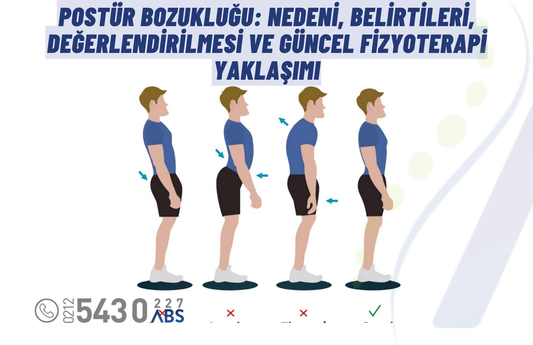 Postür Bozukluğu: Neden Olur? Belirtileri, Değerlendirilmesi ve Güncel Fizyoterapi Yaklaşımı